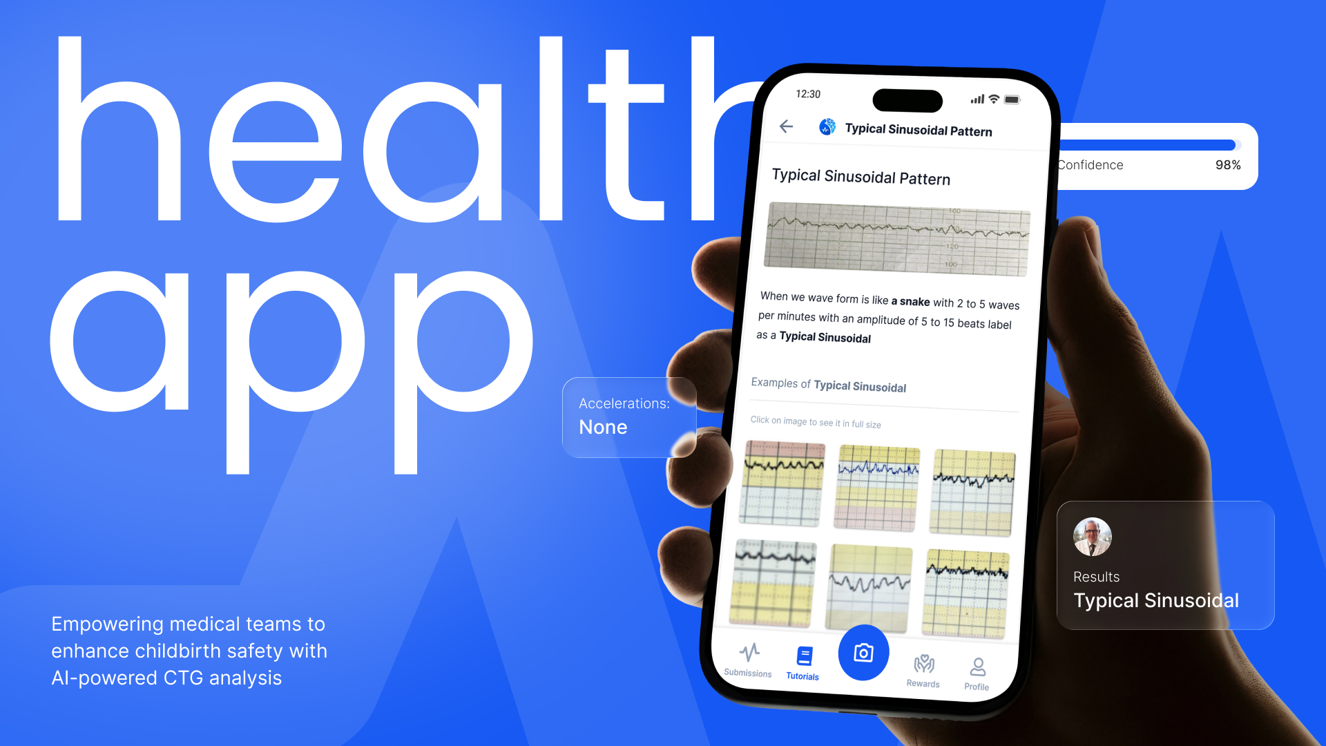 AI-Powered CTG Fetal Monitoring